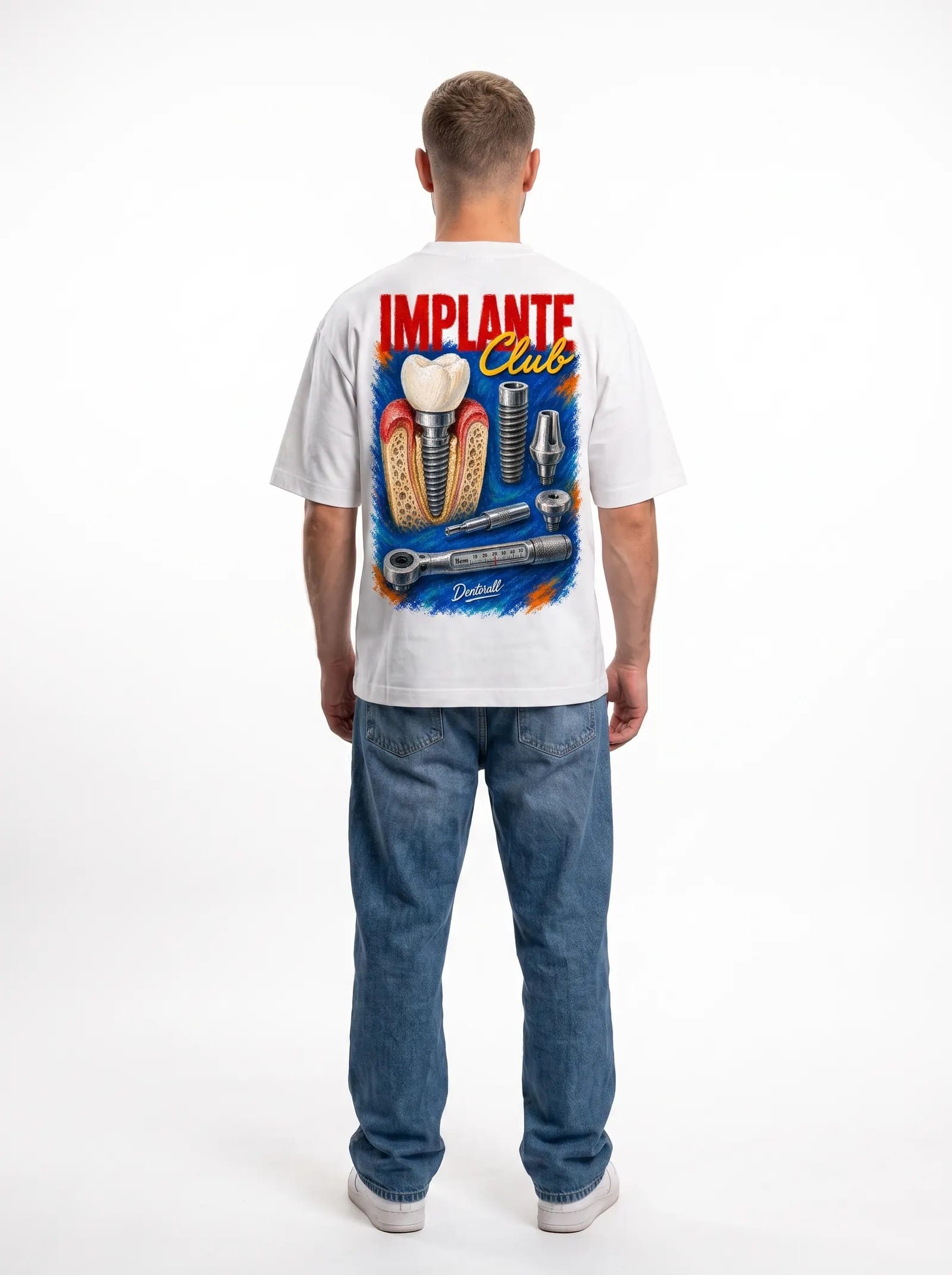 Implante Club